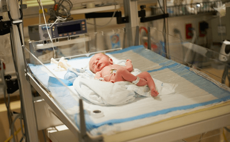 辐射式新生儿抢救台